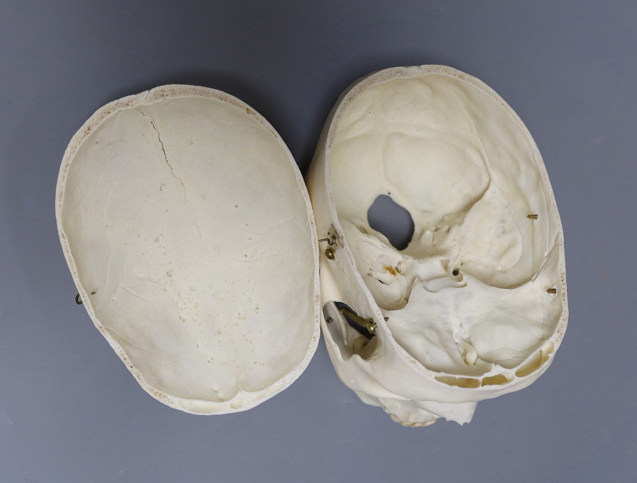 A human male skull, the vendor bought the item prior to 1977